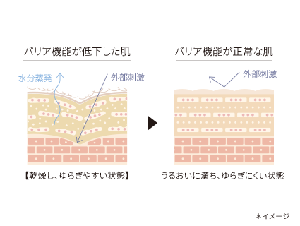 バリア機能が低下した肌とバリア機能が正常な肌