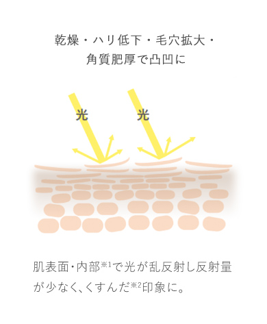 乾燥・ハリ低下・毛穴拡大・角質肥厚で凸凹に